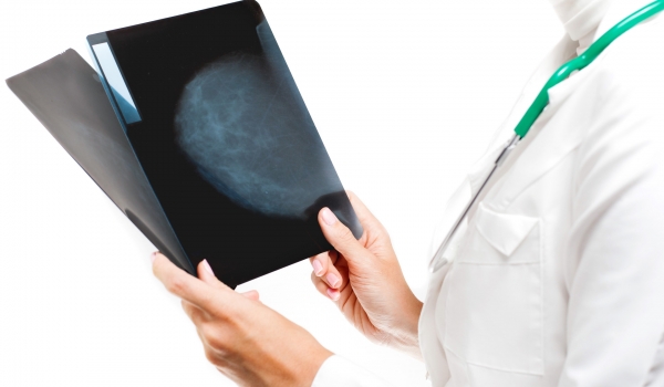 digital-mammography
