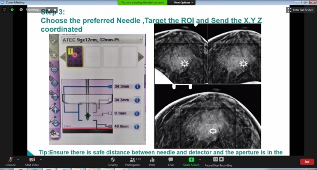 breast-imaging-webinar-course--session-3