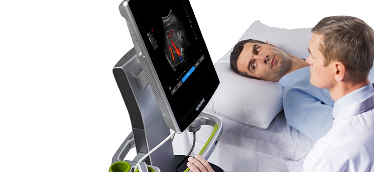 wisonic-navi-point-of-care-ultrasound