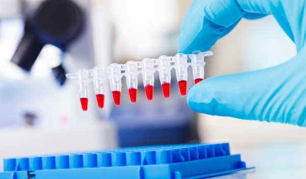 pcr-tests