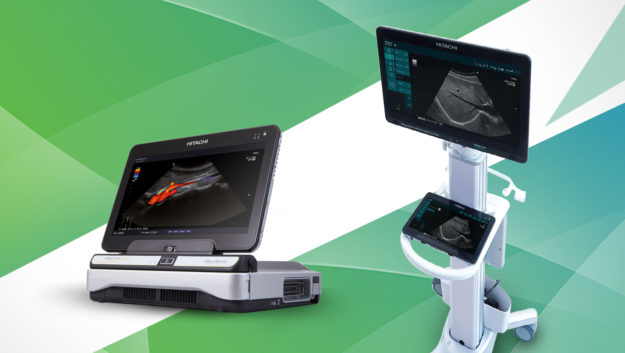 Trivitron Healthcare launches Hitachi ARIETTA Prologue & Precision Ultrasound Models in India.