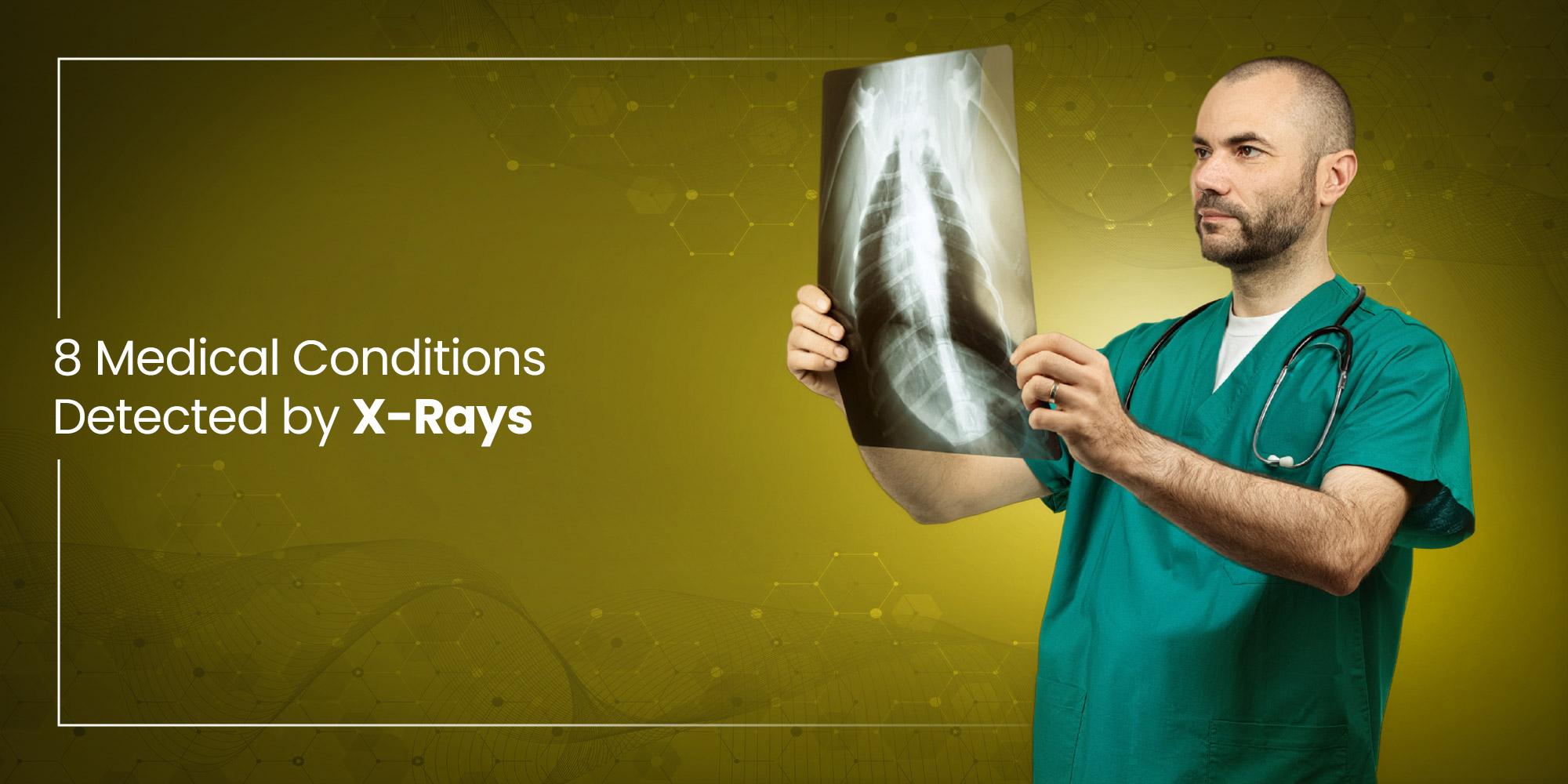 8 Medical Conditions Detected by X-Rays