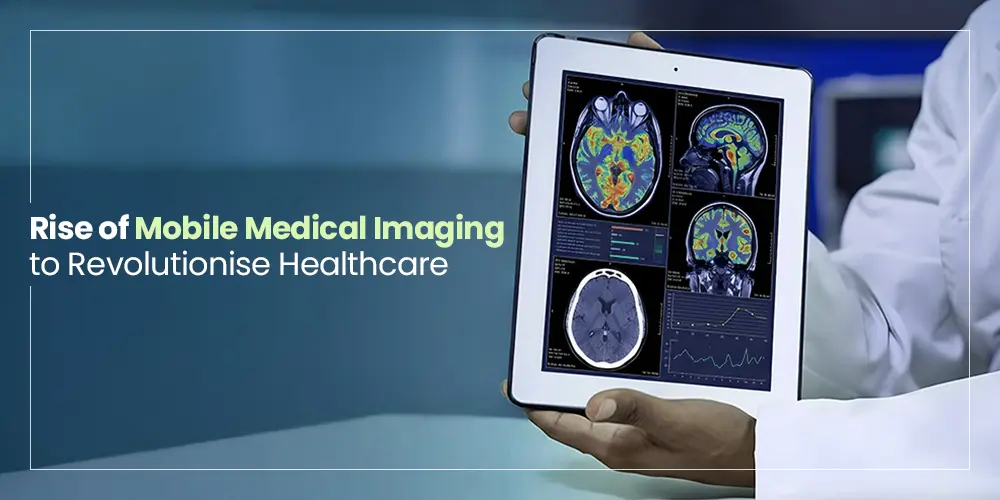 Rise of mobile medical imaging to revolutionise healthcare