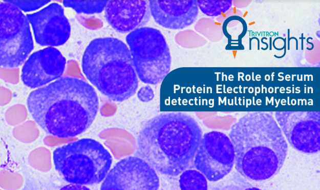 The Role of Serum Protein Electrophoresis in detecting Multiple Myeloma