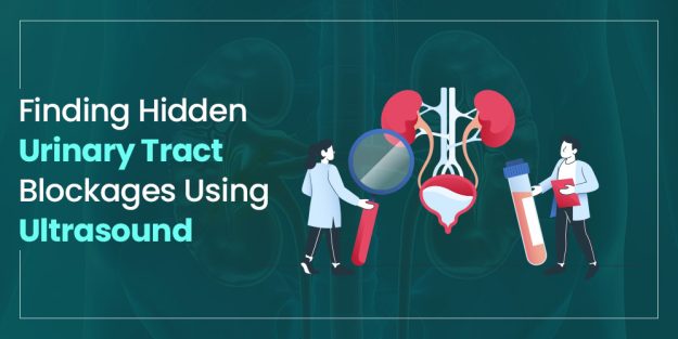 Finding Hidden Urinary Tract Blockages Using Ultrasound