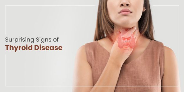 Surprising Signs of Thyroid Disease
