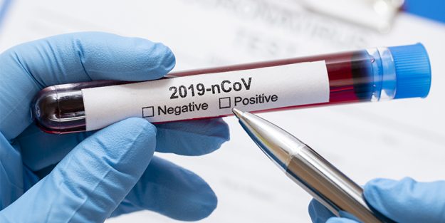 Handling, Storage and Shipment considerations for COVID-19 samples