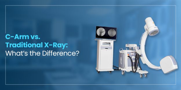C-Arm vs. Traditional X-Ray: Understanding the Key Differences