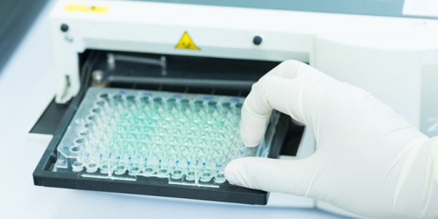 ELISA based platform for COVID-19 IgG detection-All that you need to know