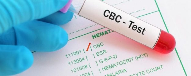 Know about the complete blood count (CBC) test