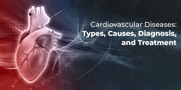 Cardiovascular Diseases: Types, Causes, Diagnosis, and Treatment