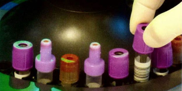 Vitality of Electrophoresis in IVD
