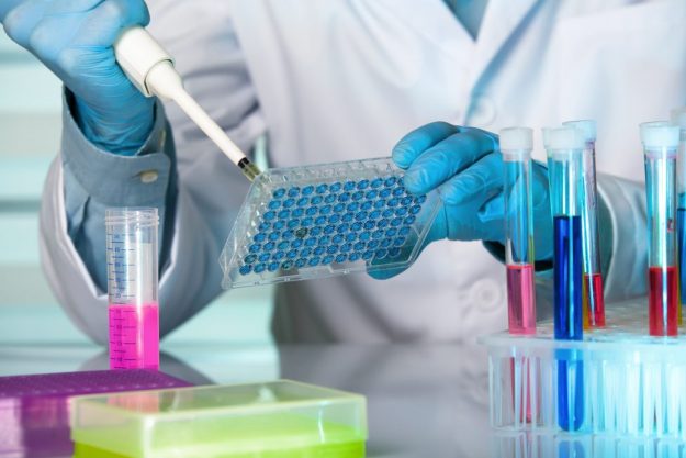 Understanding the major requirements of ELISA