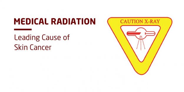 Medical Radiation- Leading Cause of Skin Cancer