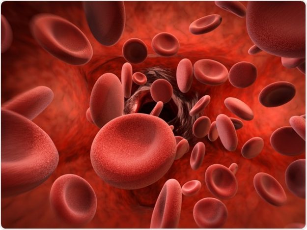Importance of Capillary Electrophoresis in screening of Hemoglobinopathies in New Born