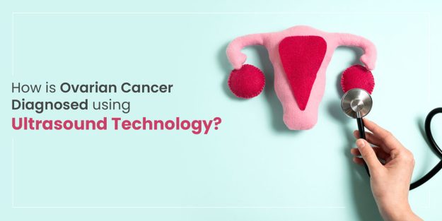 How Is Ovarian Cancer Diagnosed with Ultrasound?
