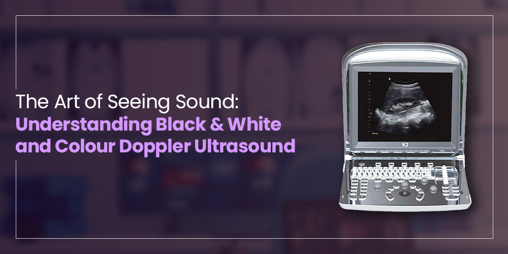 The Art of Seeing Sound: Understanding Black & White and Colour Doppler Ultrasound