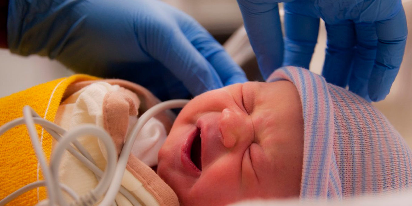 Newborn Screening for Congenital Hypothyroidism