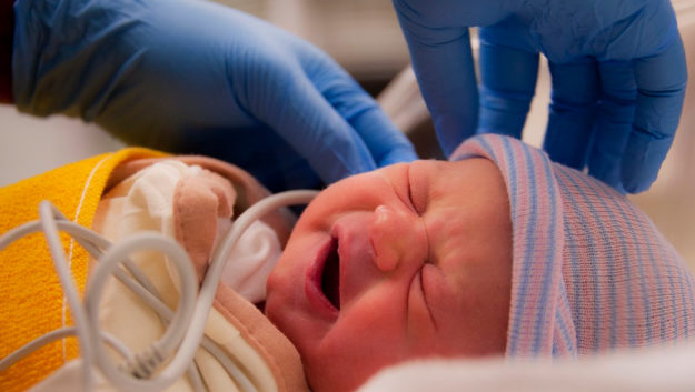 Newborn Screening for Congenital Hypothyroidism