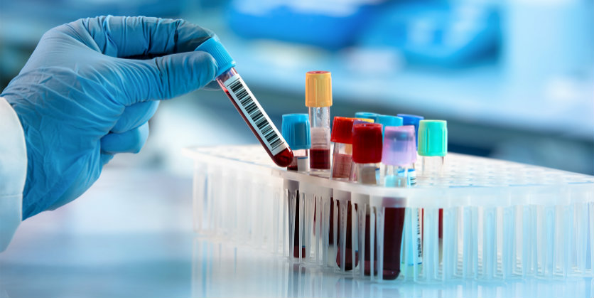 Point-of-Care (POC) testing Point-of-Care (POC) testing