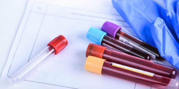 Diagnostics Blood Sample