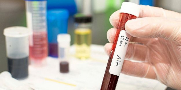 HIV test