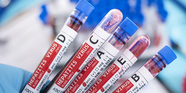 A, B, C, D & E of Hepatitis