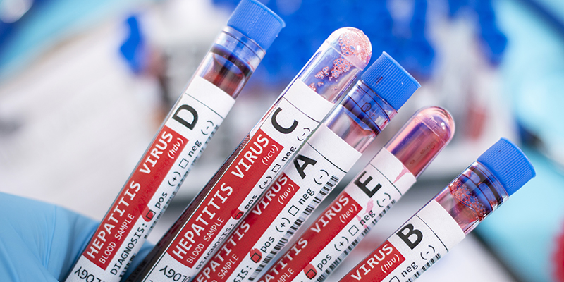 A, B, C, D & E of Hepatitis A, B, C, D & E of Hepatitis