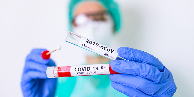 Role of RT-PCR, ELISA IgG & Covid Antigen in Covid-19_800x400