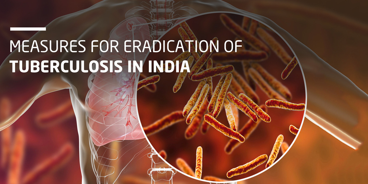 Eradication of Tuberculosis