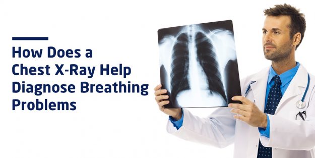 A chest X-ray image showing the lungs and rib cage in grayscale