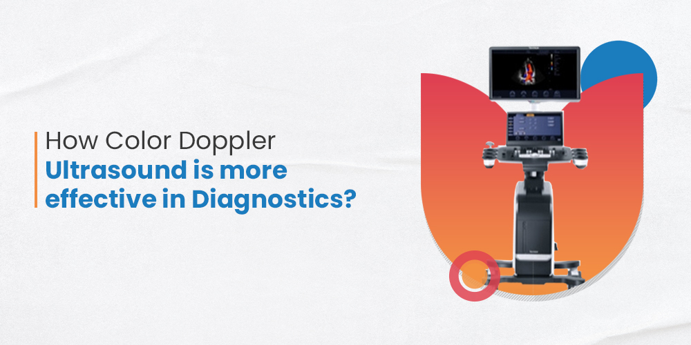 Color doppler ultrasound machine - Trivitron Healthcare