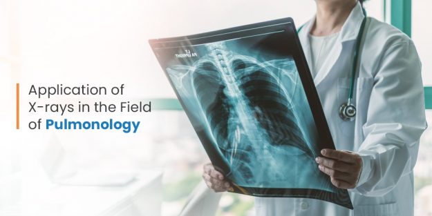 X-ray in the feild of Pulmonology - Trivitron Healthcare