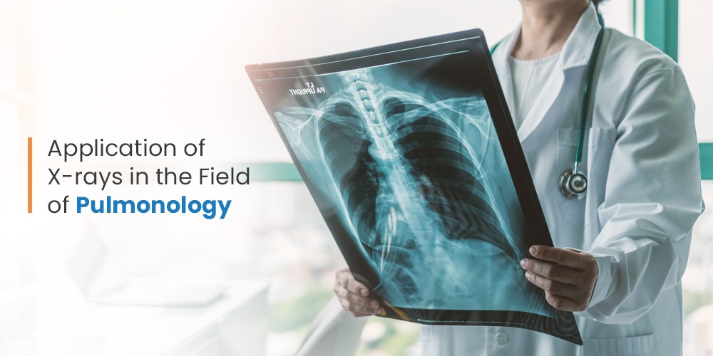 The Role of XRays in Pulmonology Applications and Advancements