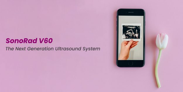 SonoRad V60 - A color doppler ultrasound machine by Trivitron Healthcare