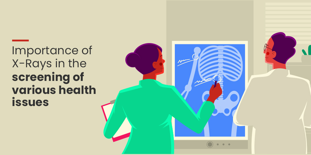 XRays Diagnosis & Benefits in Modern Healthcare