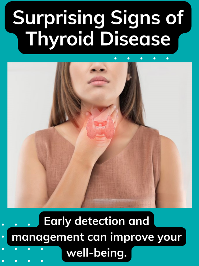 Surprising Signs of Thyroid Disease You Need to Know