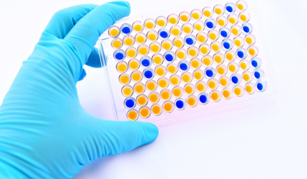 Fluoro Enzymatic Assays